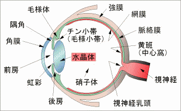 白内障