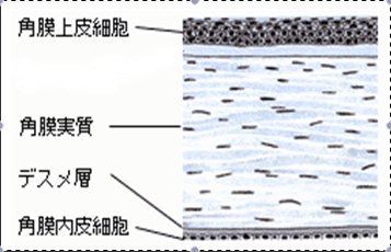 角膜潰瘍